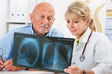 The Importance of Exercise in Lung Cancer Research 1 lungs