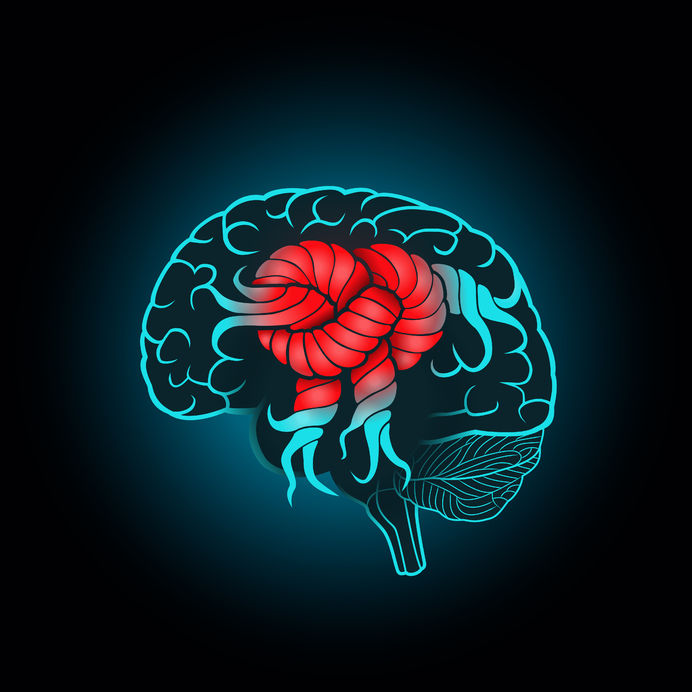brain in a knot