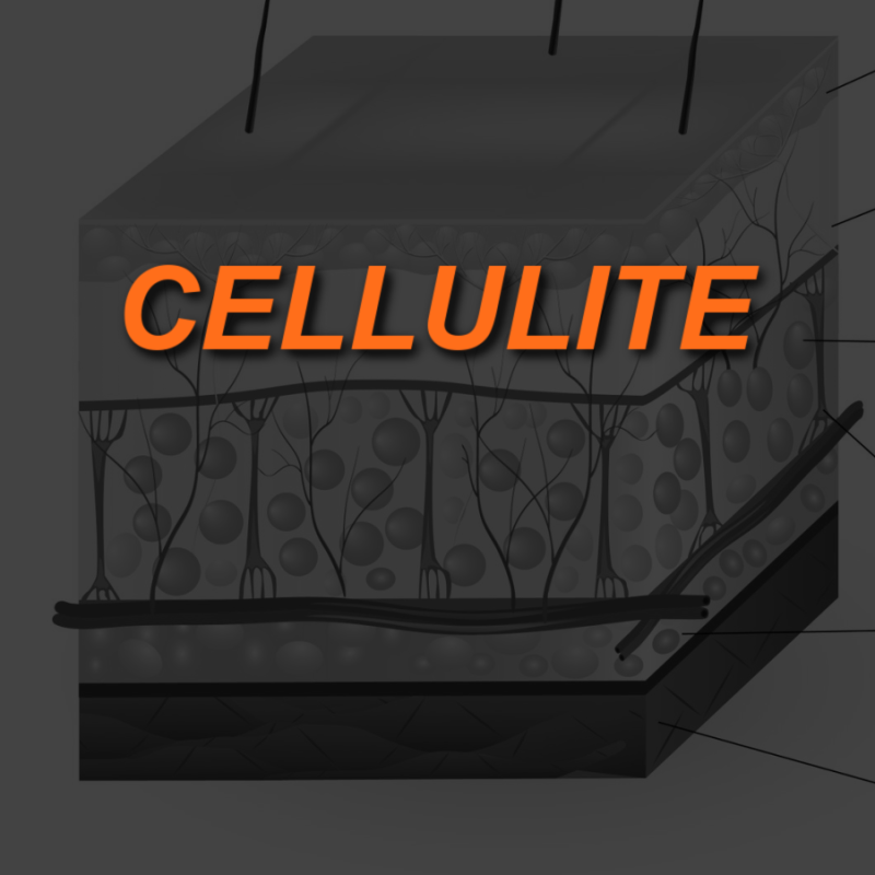 CELLULITE IMAGE