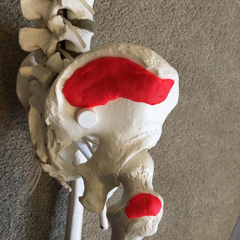 Gluteus Medius: Two of Three Glutes 1 gluteus medius