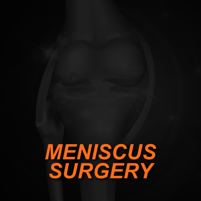 MENISCUS SURGERY