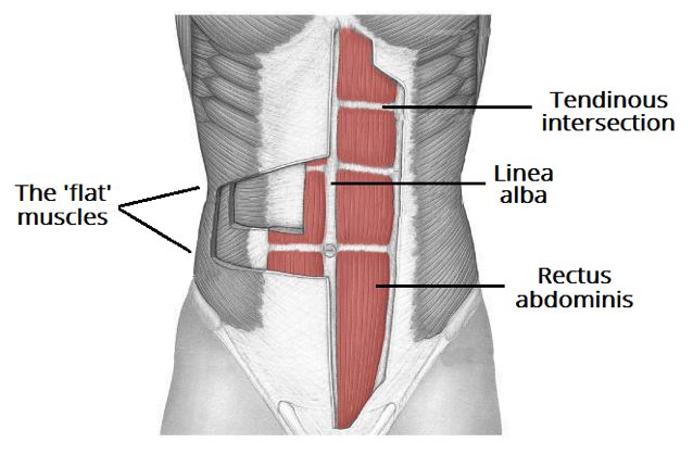 Abdominal image Diastasis Recti