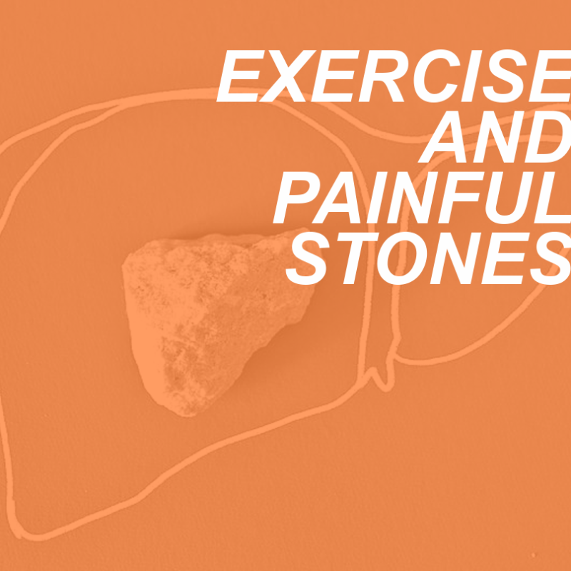 Kidney and Gall Stones: Can Exercise Help or Hinder? 2 STONES AND EXERCISE
