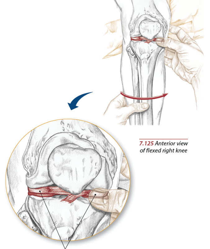 Meniscus Anatomy and Injuries 2 knee
