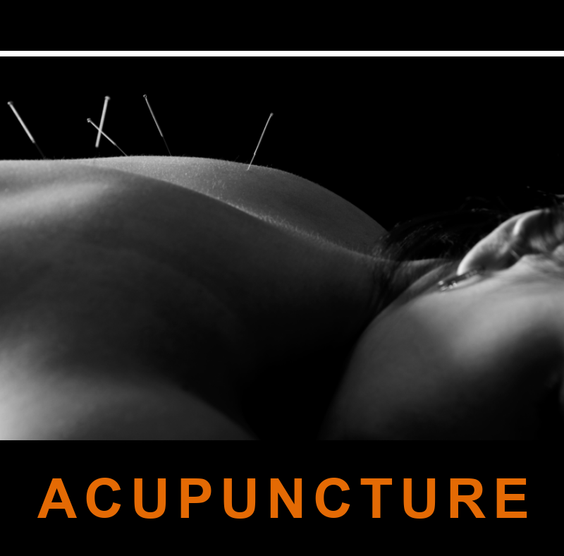 Acupuncture and Athletes 2 Acupuncture