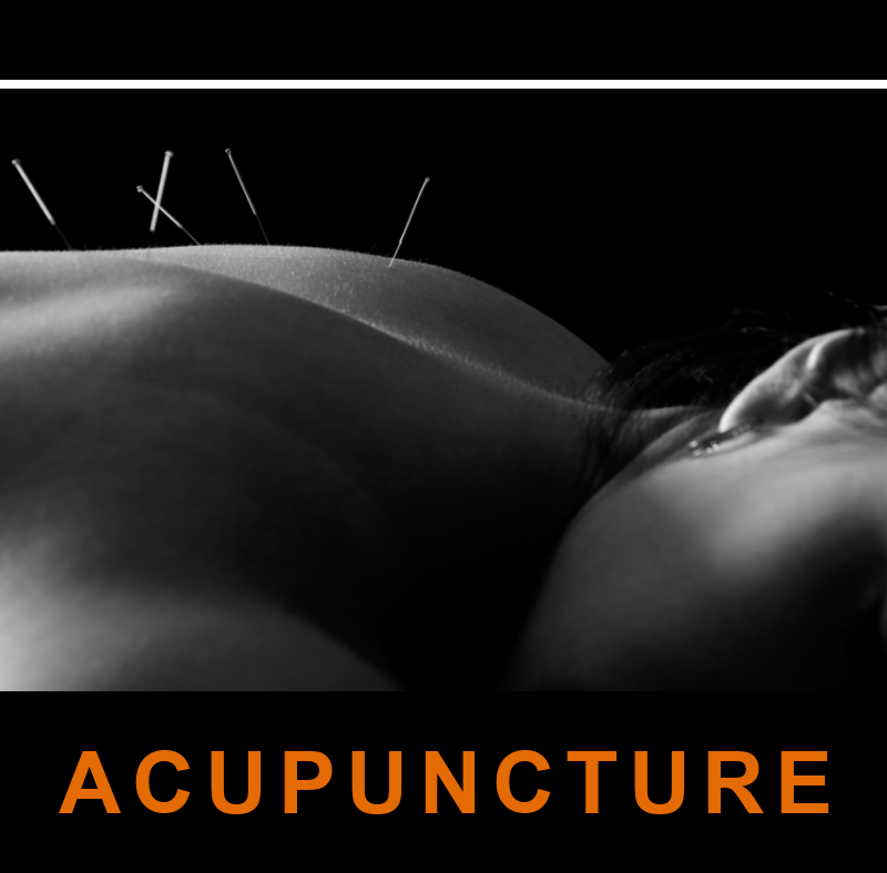 Acupuncture