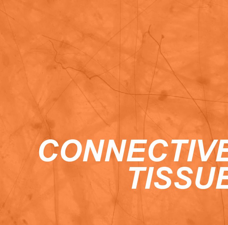 Understanding Connective Tissue 2 Connective Tissue
