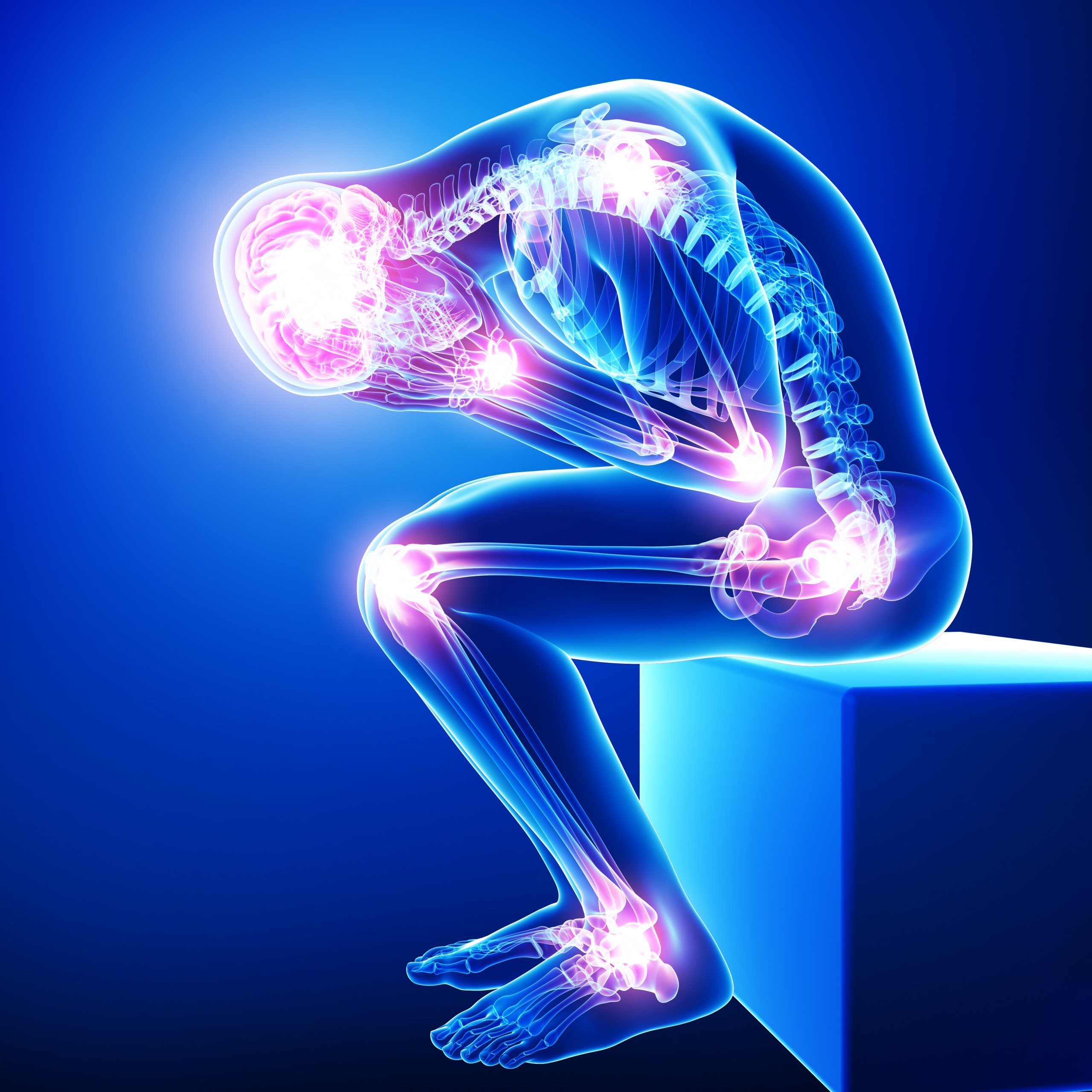 Clients with Arthritis: Effective Personal Training Strategies and Exercise Approaches 2 Arthritis and Joint Pain Points