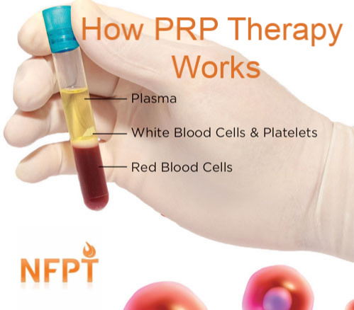 How Prp Works