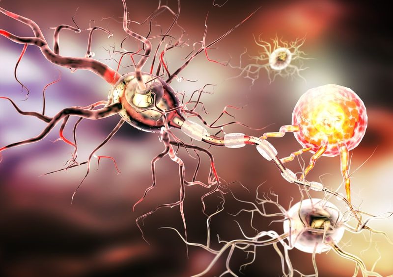 Multiple Sclerosis & Fitness: Helping a Client with MS Progress from Multi-Symptom to MegaStar 2 nervous system MS